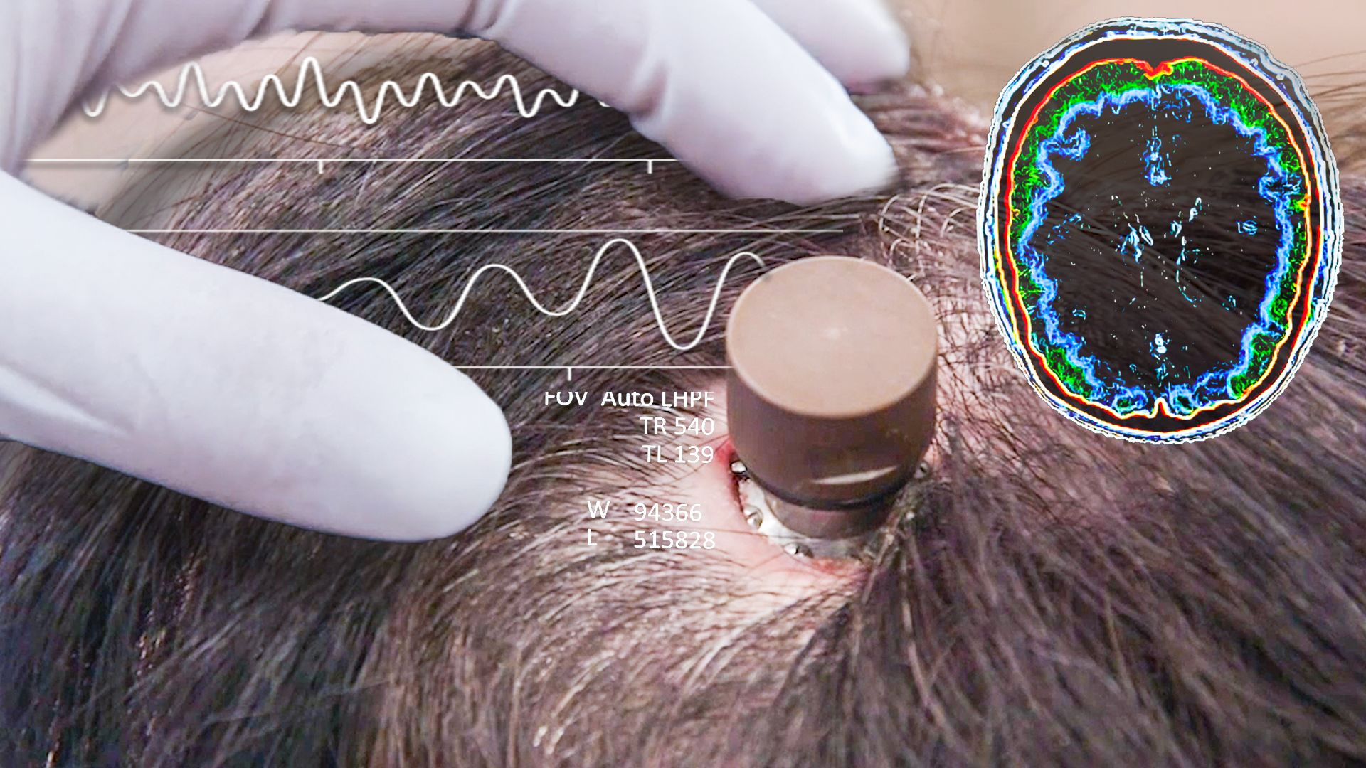 Chip Neural: Memahami Otak Digital dan Masa Depannya