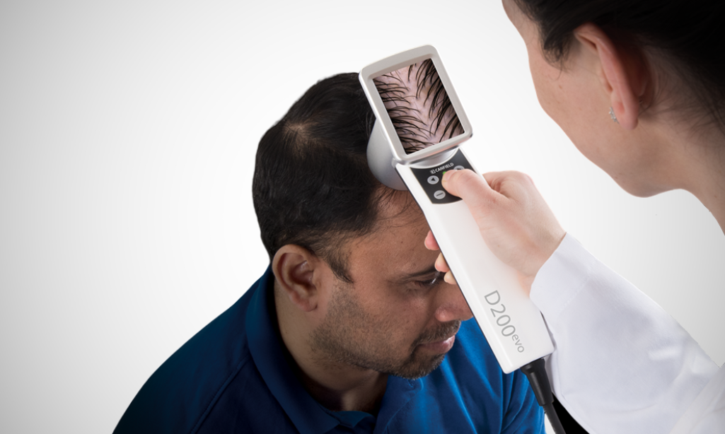 Hair Scanner