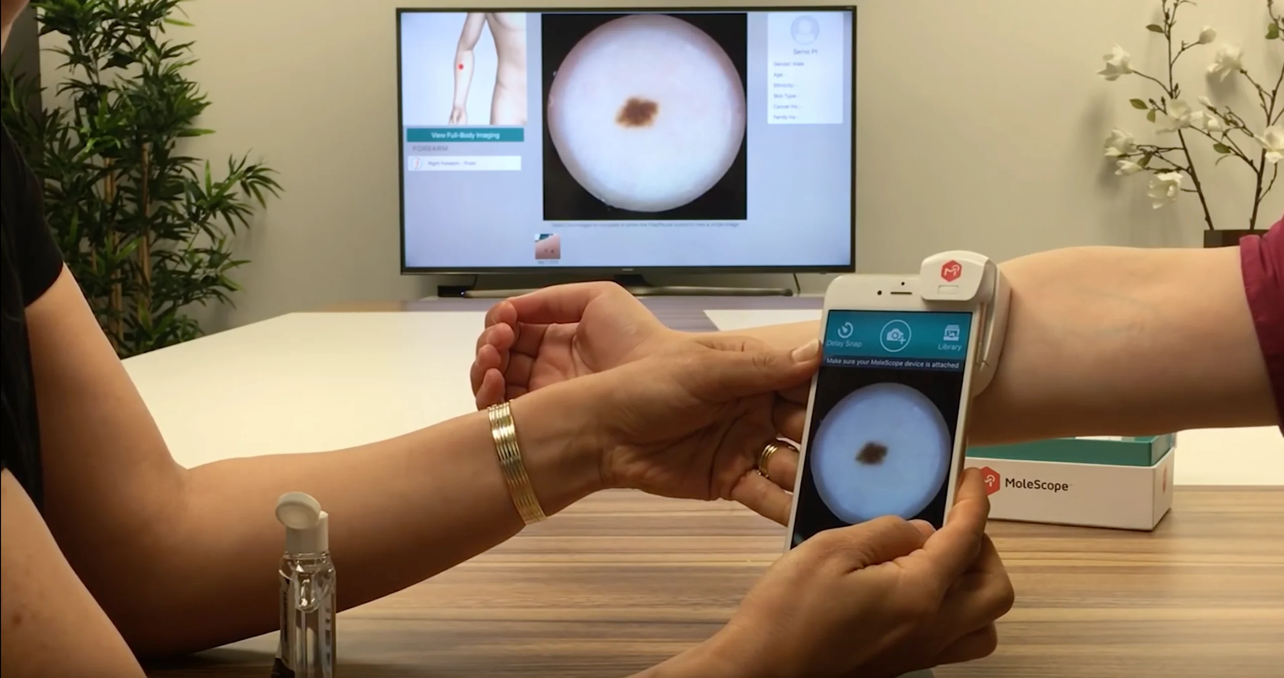 Digital Dermatoscope
