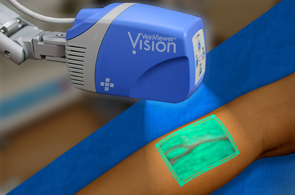 Vein Scanner