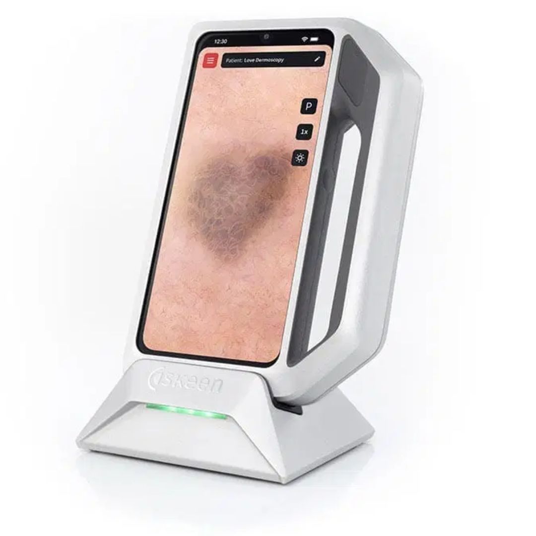 Digital Dermatoscope