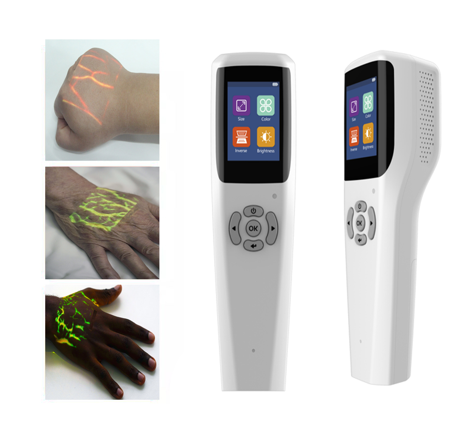 Vein Finder